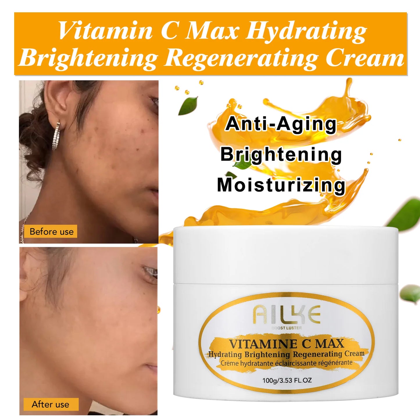 KYLIEFIT Freckles Whitening Face Cream For Dark Spots