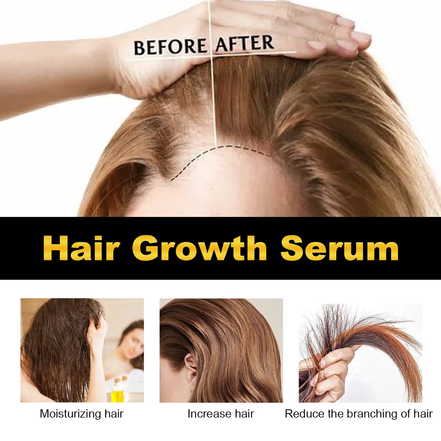 Zen Active Living Castor Oil For Hair Growth And Scalp Nourishment
