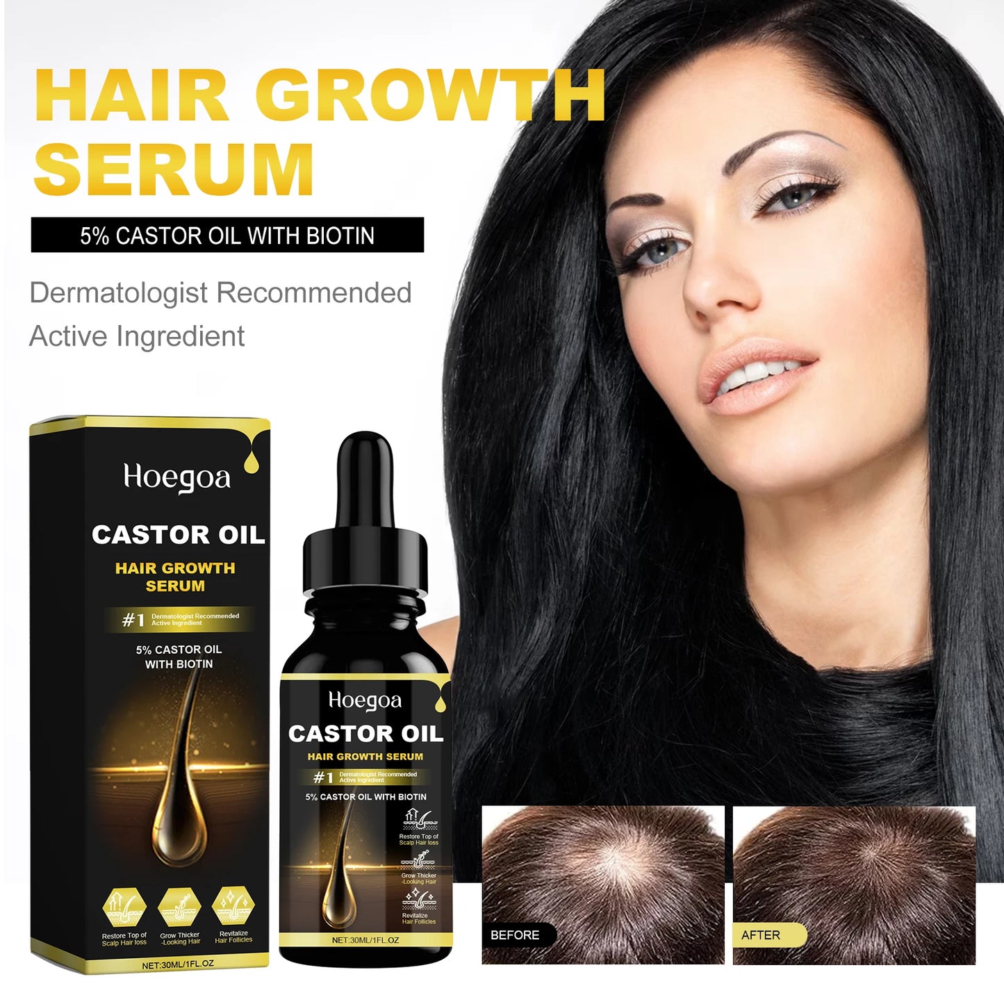 Zen Active Living Castor Oil Hair Growth Serum For Thicker Hair