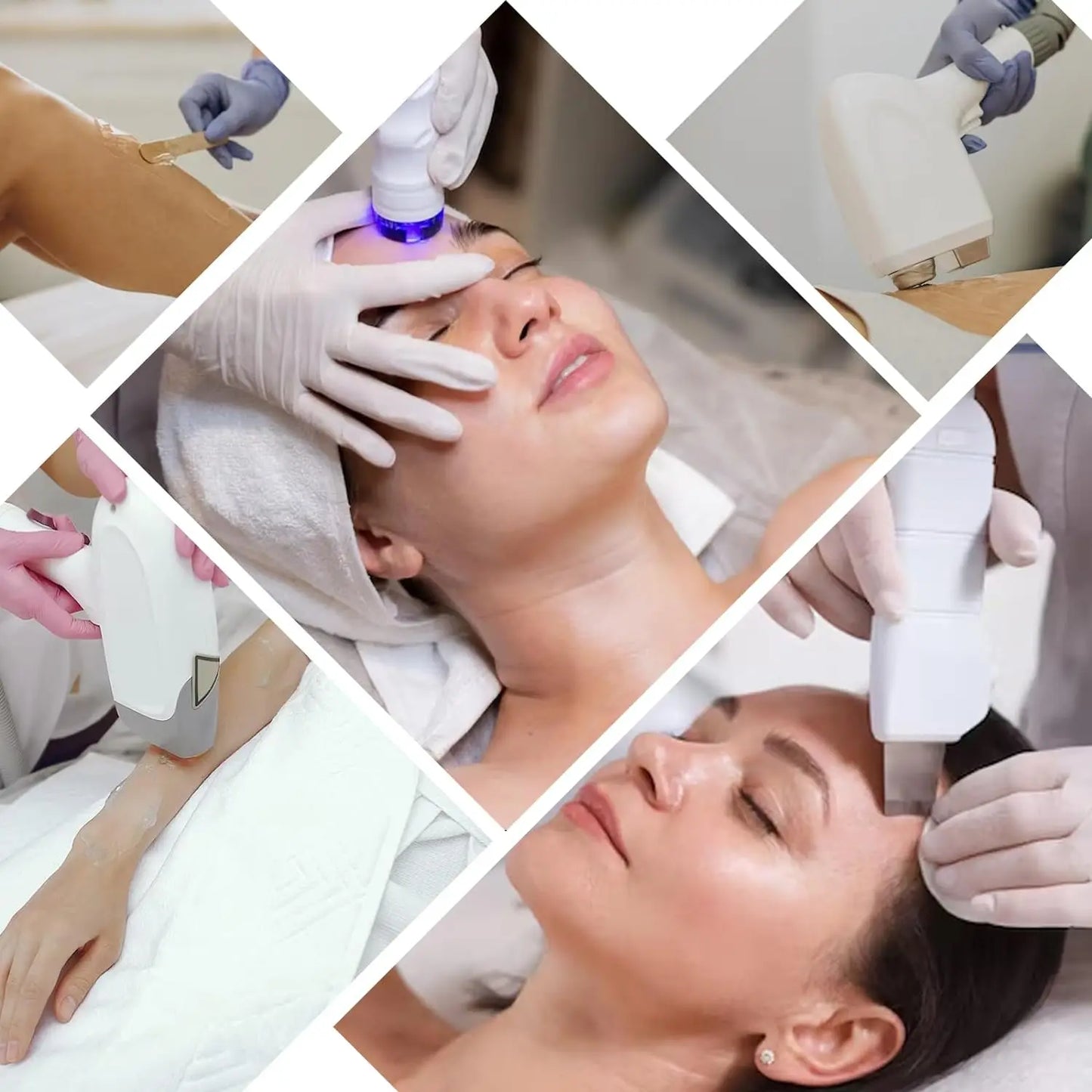 YMEYFAN Hyaluronic Acid Hydrating Ultrasound Gel for IPL