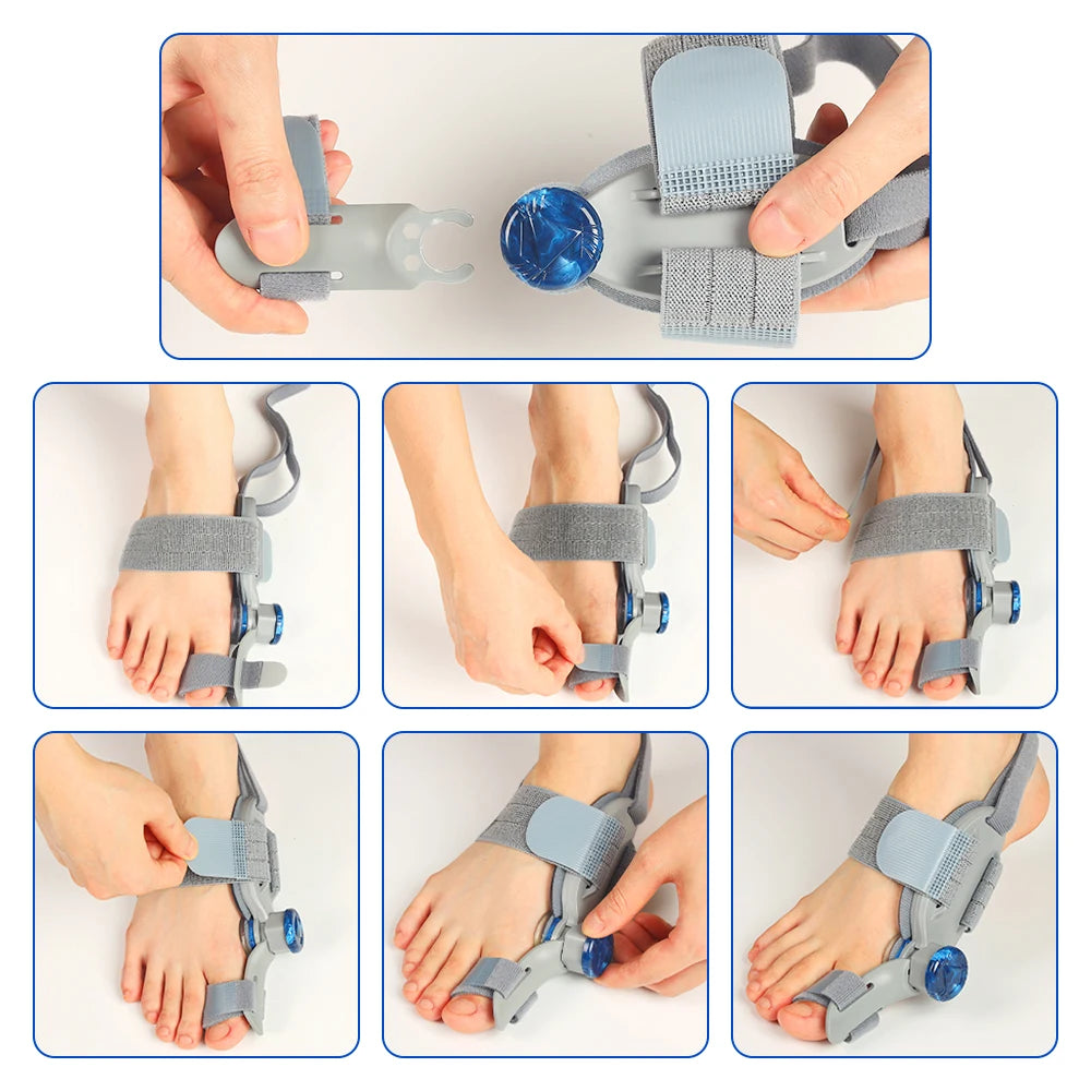 Bunion Corrector Toe Separator Foot Hallux Valgus Braces Orthotics Feet Bone Adjuster Correction Toe Straightener Foot Care Tool