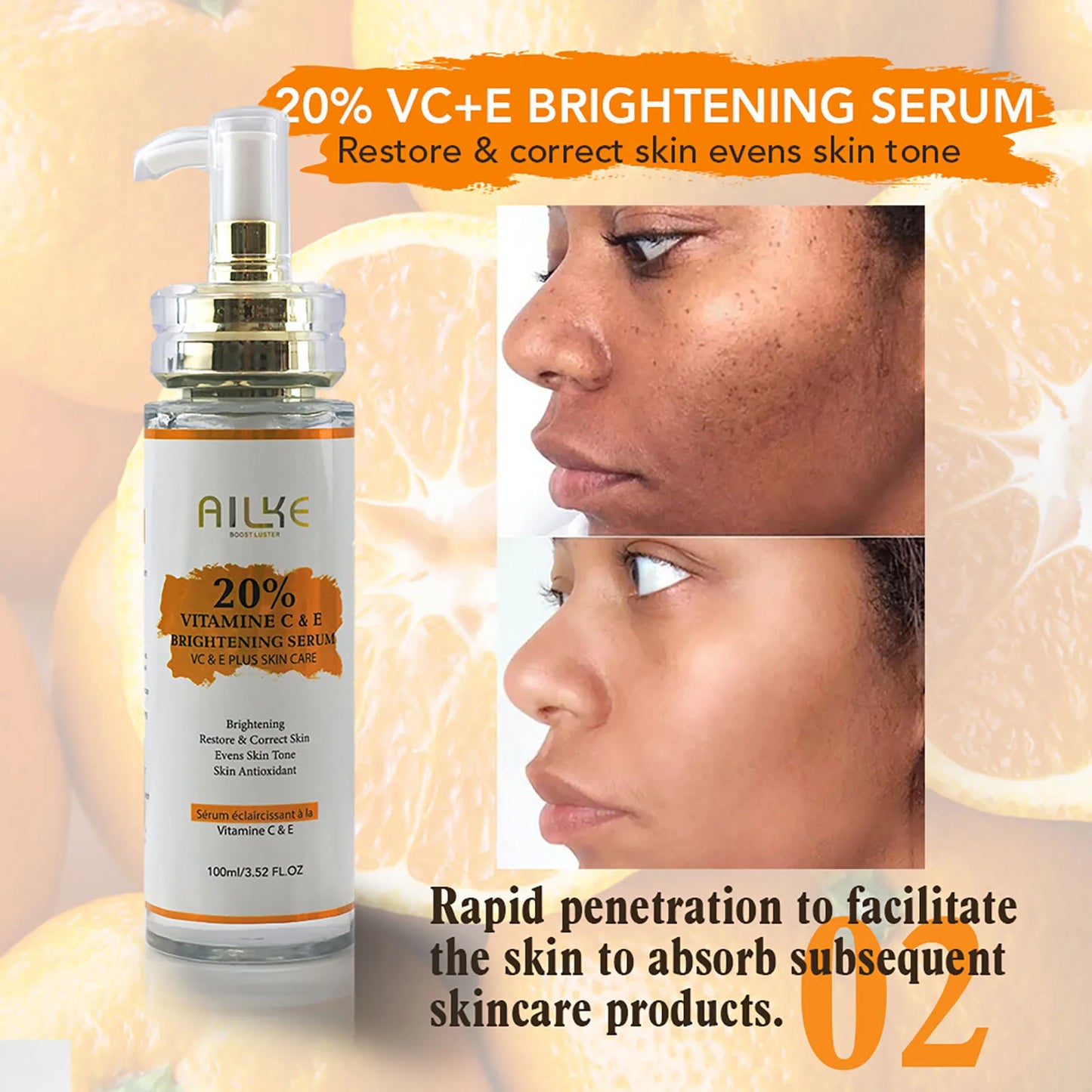 KYLIEFIT Freckles Whitening Face Cream For Dark Spots