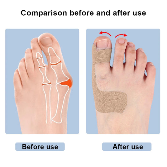 10Pcs Bunion Corrector Toe Correction Band Breathable Toe Separator Self Adhesive Hallux Valgus Orthosis Corrector for Men Women