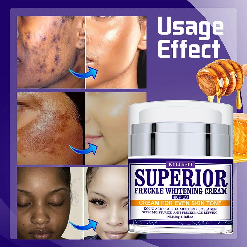 KYLIEFIT Dark Spot Remover Face Hyperpigmentation Melasma Cream