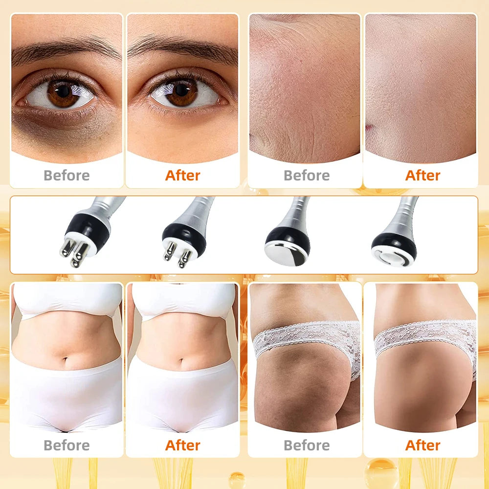 Moonic Beauty 4 In 1 Cavitation Machine 40K UltrasonicRF